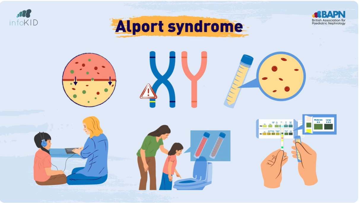 Video Preview for Alport Syndrome