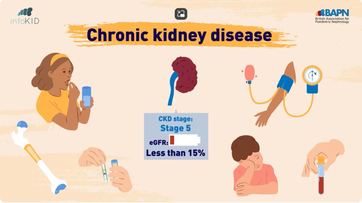 Video Preview for CKD