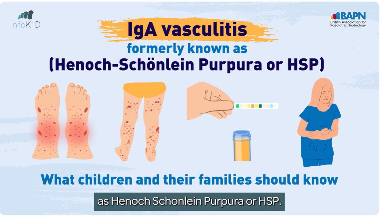Video Preview for HSP