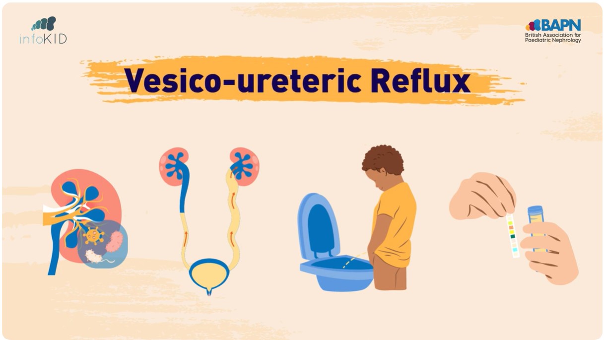 Video Preview for Reflux
